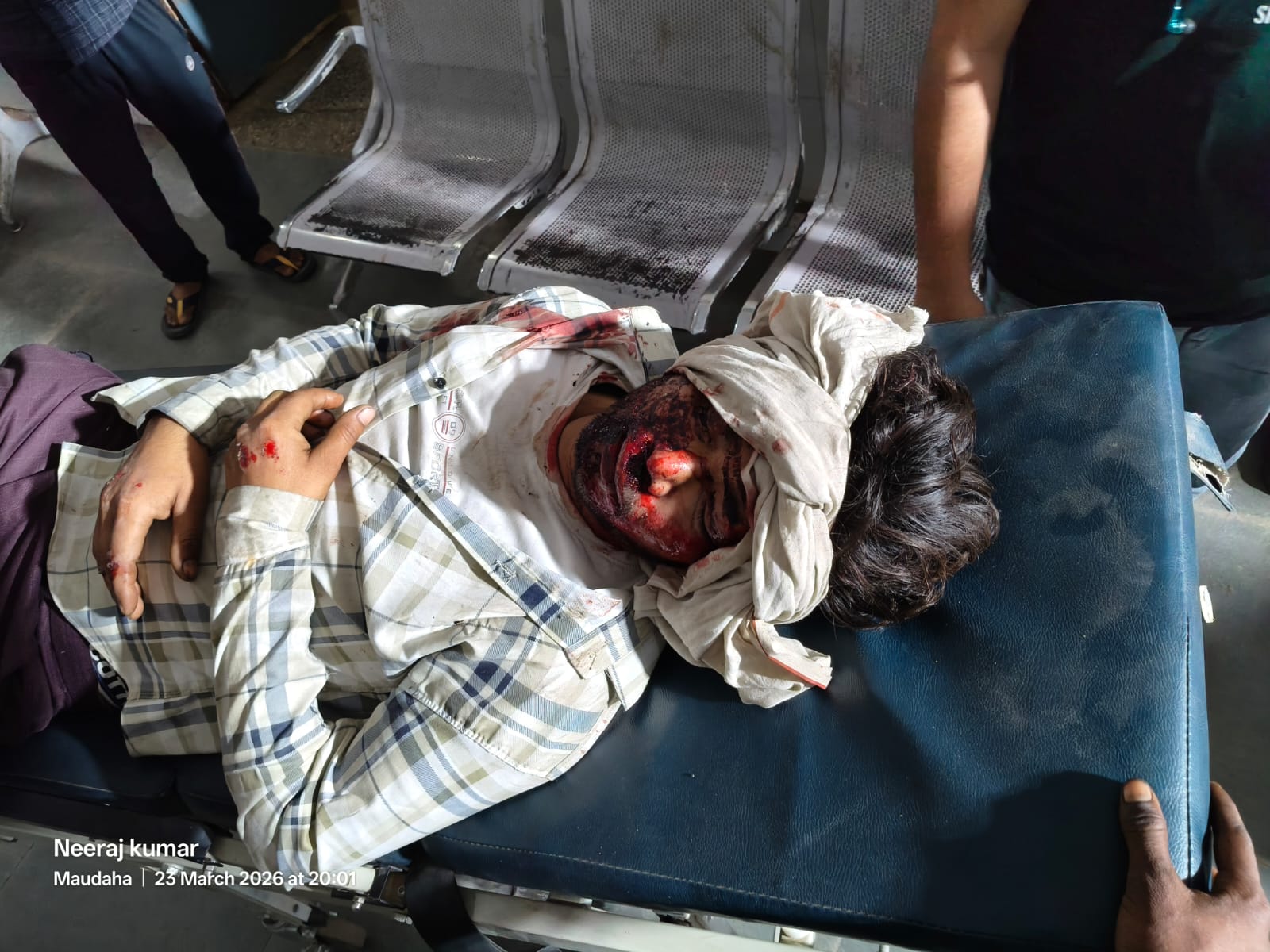 बाईक सवार युवक बैलगाड़ी से टकराकर गंभीर रूप से घायल