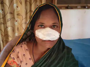 आपसी विवाद में महिला की नाक काटी