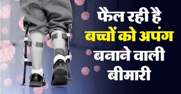 मम्प्स-मीजल्स के बाद अब नई आफत